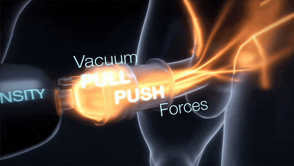 Xtensity 1 - Unique Push & Pull Premium Masturbator - PlayBlue
