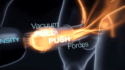 Xtensity 1 - Unique Push & Pull Premium Masturbator